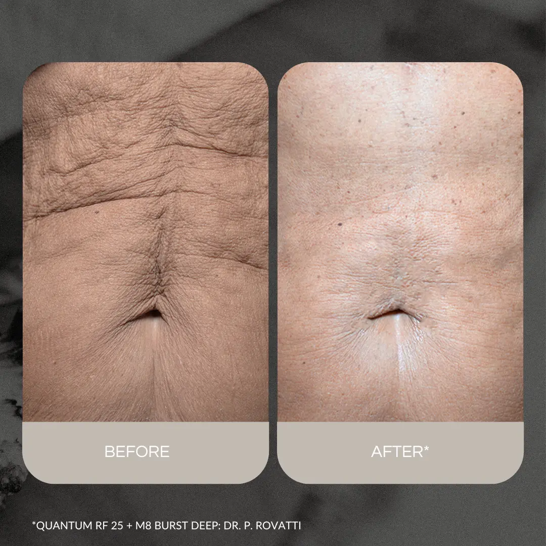 Kép erről: Nevtelen 1080 x 1080 keppont 1