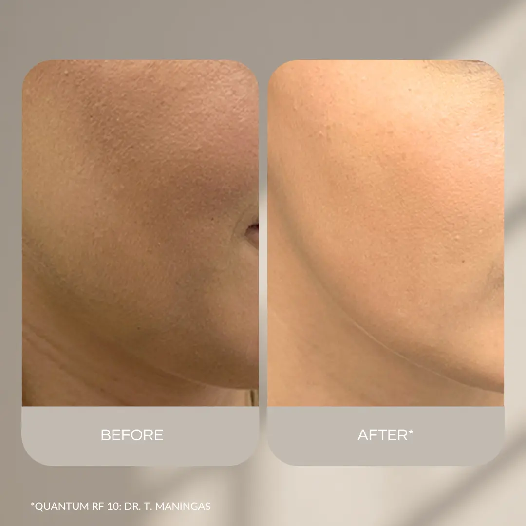 Kép erről: Nevtelen 1080 x 1080 keppont 2