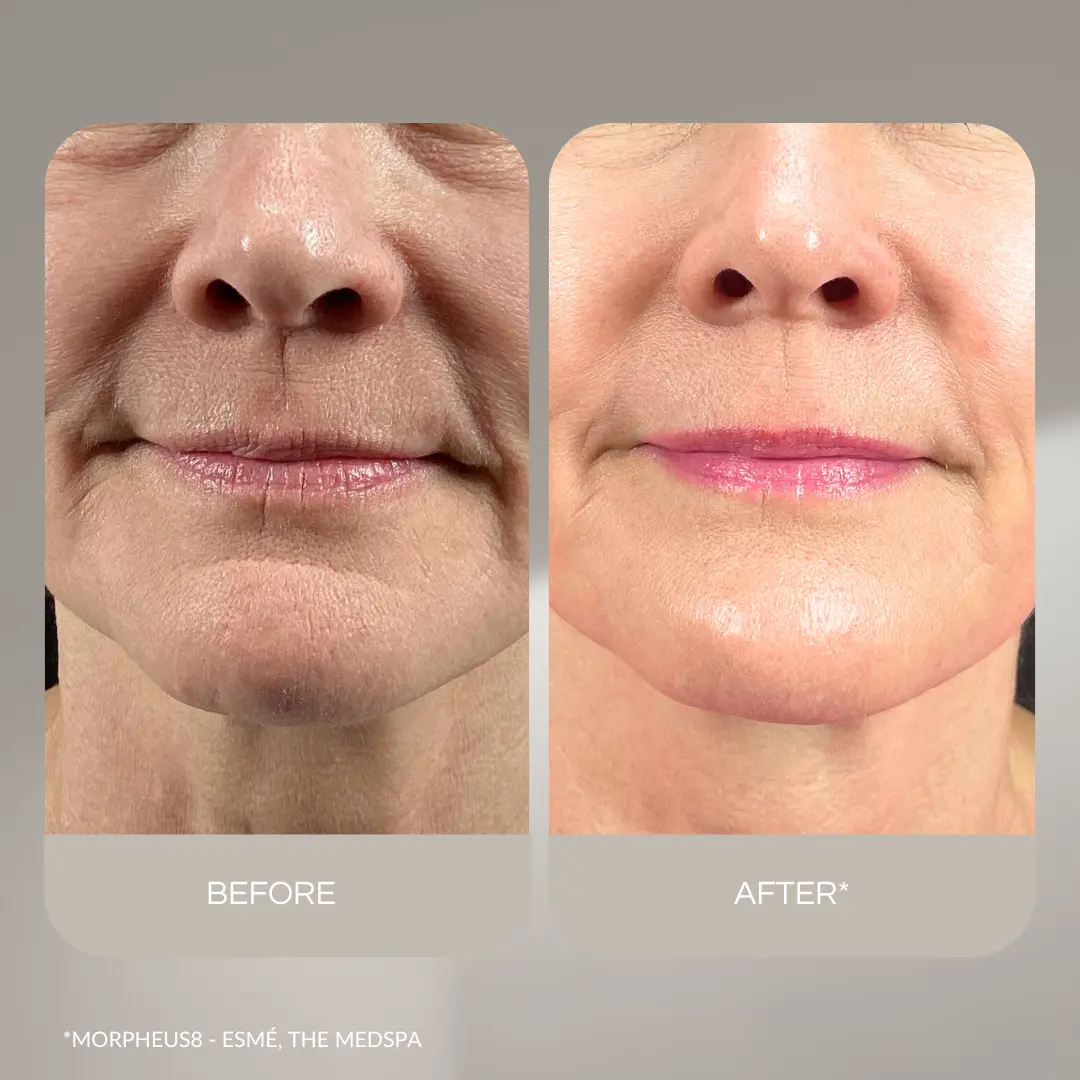 Kép erről: Nevtelen 1080 x 1080 keppont 3