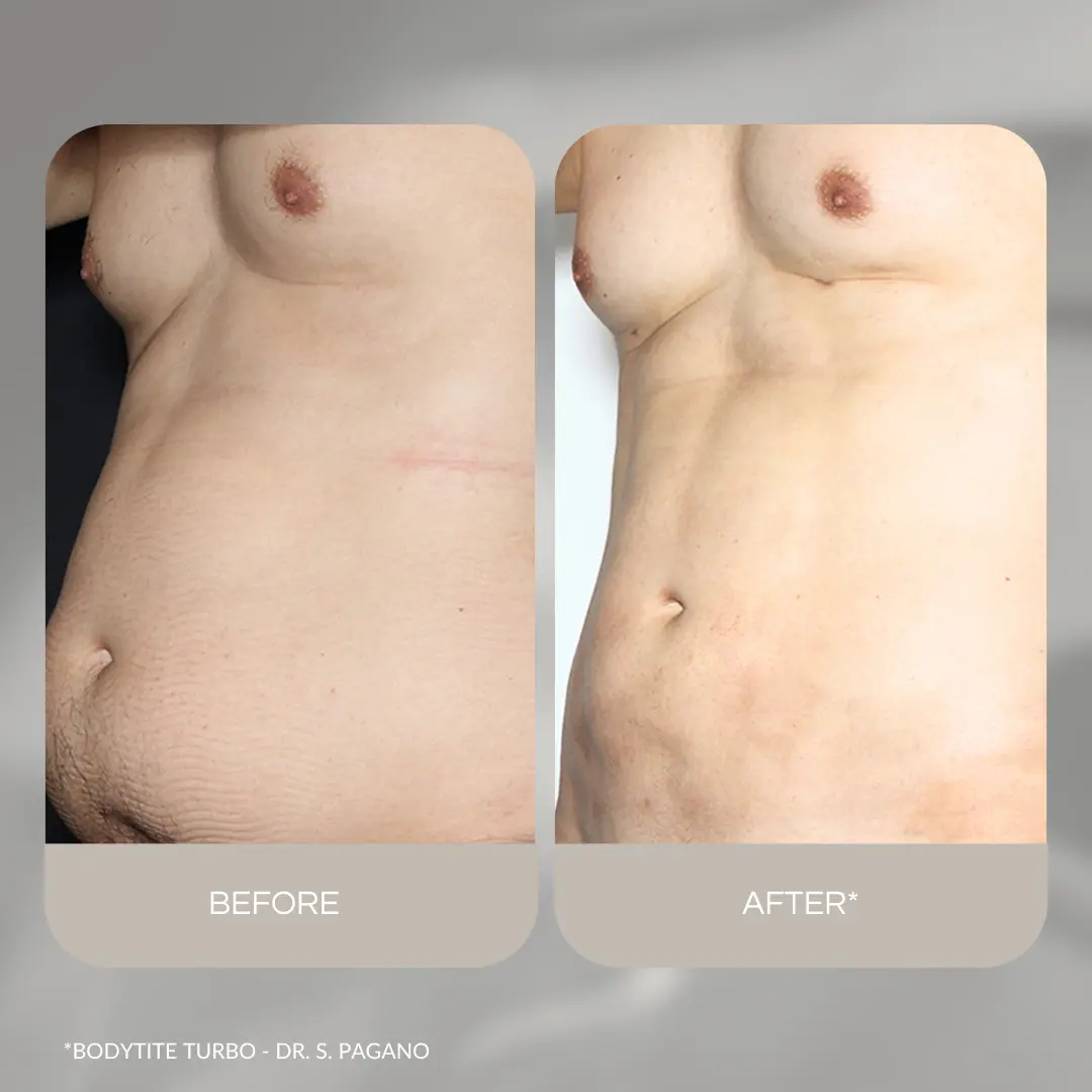 Kép erről: Nevtelen 1080 x 1080 keppont 4