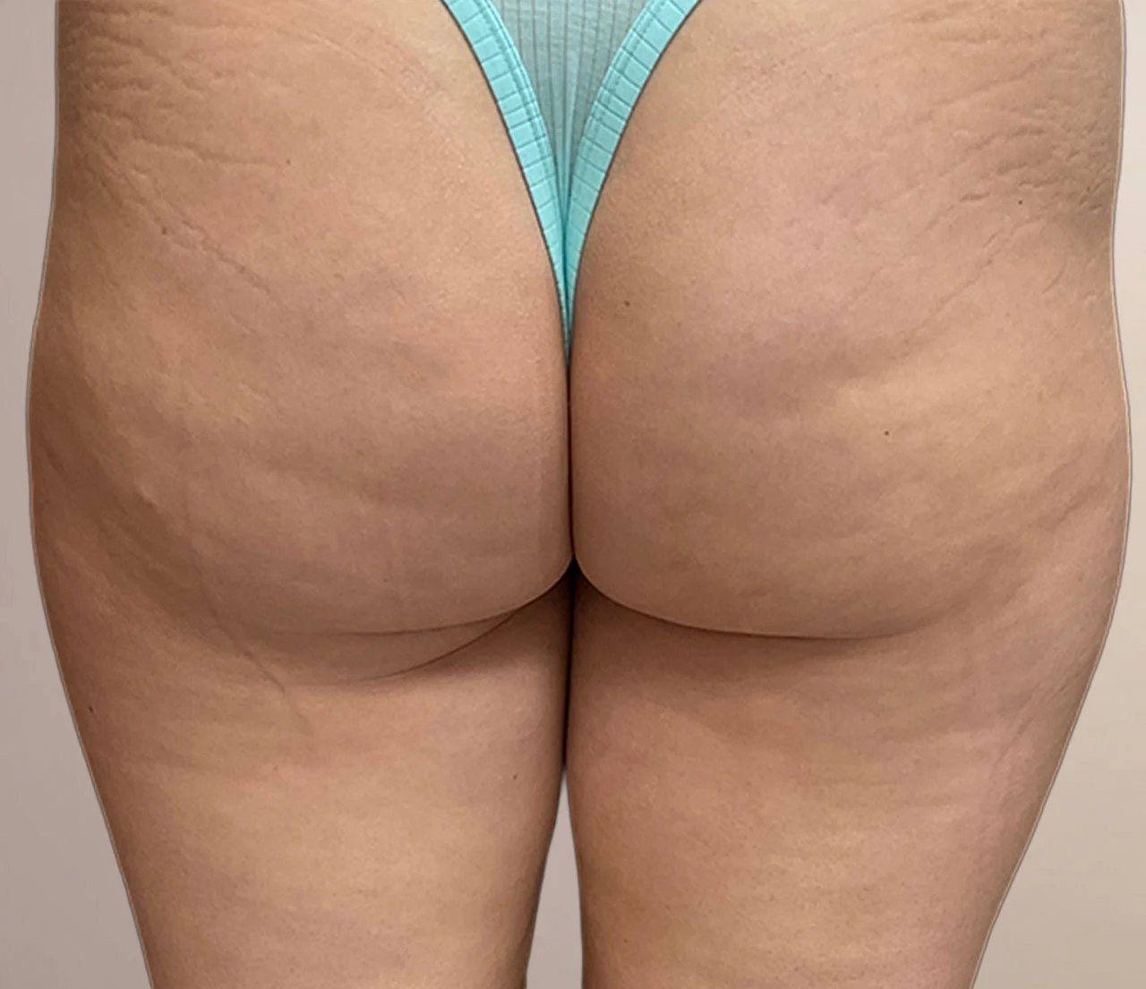 Ezen a képen egy barna hajú modell lány látható egy stúdióban.